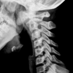 Parte cuello (Rap)(250 BSF)