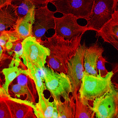 The Amygdala - Noisentia (Inspired by Tool)