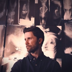 Bird - CHRY 105.5FM Interview