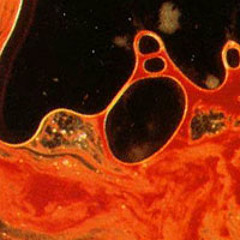 Ronnie Metallica Cover