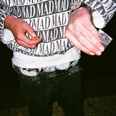 Your nose is bleeding