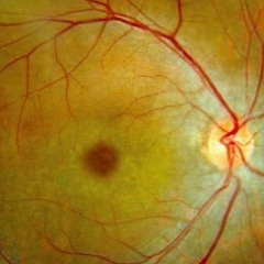 O Lado de Dentro dos Olhos