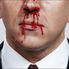 Volume - Nose Bleed (Original Mix)