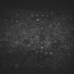 EUNUCH - SOMETHINGWRONGWITHMYBRAIN