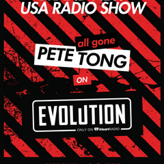 Ninetoes Live Mix for Pete Tong's 'All Gone Pete Tong @ The Evolution' Radio Show on iHeartRadio.com