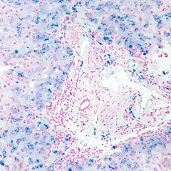 Knowledge (Operation Ivy Cover)