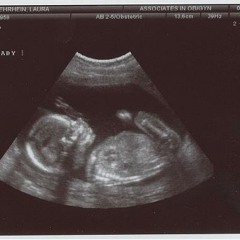 Ultrasound Of A King