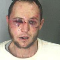 Hematite - Assault on an officer