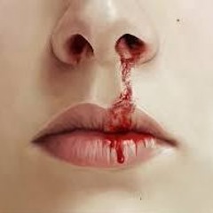 Bleeding Nose - Bleeding Fingers Contest Madmanmike Edit
