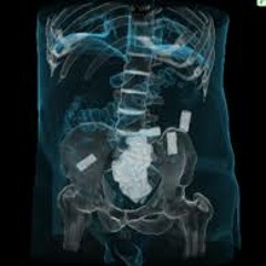 Pezmo Ft Blatant - Drug Mule [CLIP]