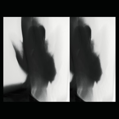 II