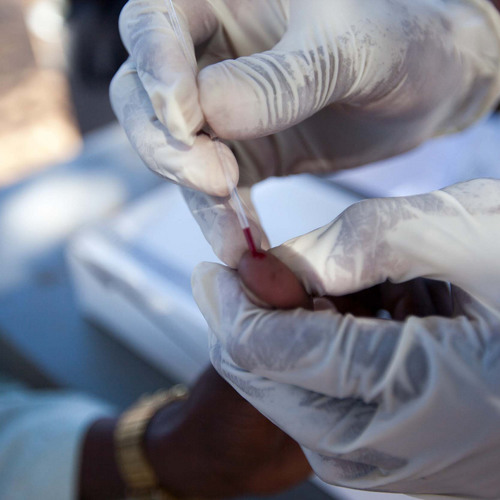 HIV treatment as prevention in Africa
