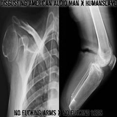 No Fucking Legs