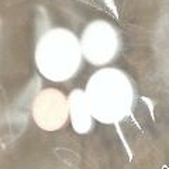 수면제가 필요해