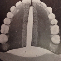 Frits Wentink - Geeses - Ishmael Remix (Clip) WOLFEP024