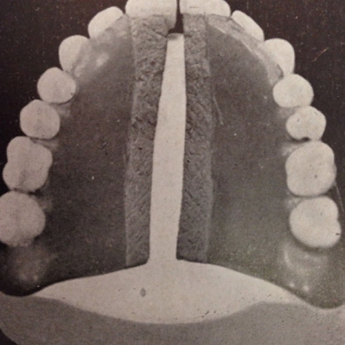 Frits Wentink - Goose (WOLFEP024 )