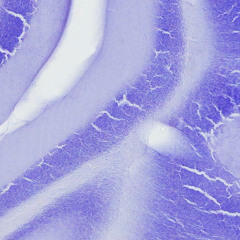 Ego (Burial, Four Tet, Thom Yorke cover)