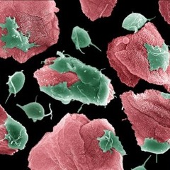 Wormholes In My Head