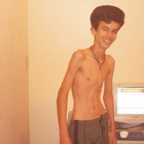 Garoto Guloso