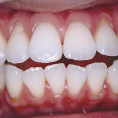 Gas Pedal (saen. edit)