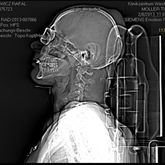 Hard Rythm - Roland Van Banks (Sonic Machinist Remix)