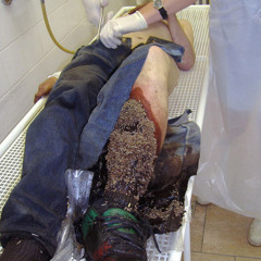 Maggots Love The Flesh