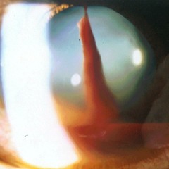 Observation #137