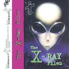 X-Ray - The X-Ray Files 1 - Side B