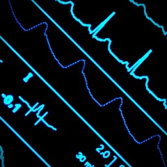 Arrhythmia - Tek Tfin