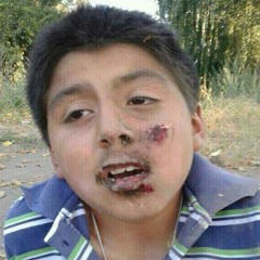 El tarro se saco la chucha