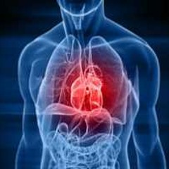 Aceleración del pálpito - Sonsarri (Demo)