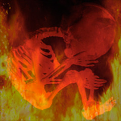 Shapen in Iniquity pt. 1