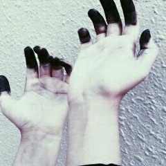 ذَبحَني غَلاك().*