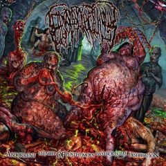 Epicardiectomy - Vaginal Colony Full of Vermin