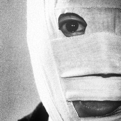 Removing The Bandages