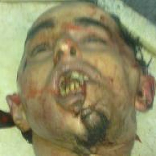 Asphyxiated