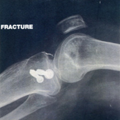 Pinguinz - Fracture Jul 2014