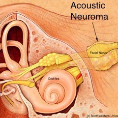 Trouble Loves Me - Morrissey (Acoustic Cover)