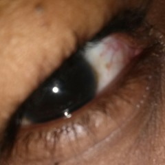 Eye - Bankroll