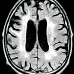 Ictus (Prod. Lokito)