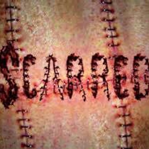 SCARRED VENOM & ANONYMOUS (MASTER COLLAB))