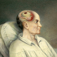 Head Trauma - Feat. Detrimeant (Prod. Heavan Instrumentals)