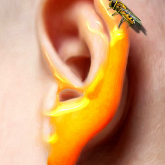 -SaxoLoco -(sweet Honey)