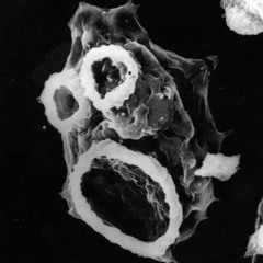 Naegleria Fowleri (Territorial Amoeba Rework)