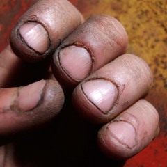 Postcards From Auschwitz - Fingernail Grime