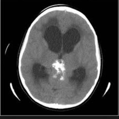 Paul D ft Keyzon - Cant Do Us