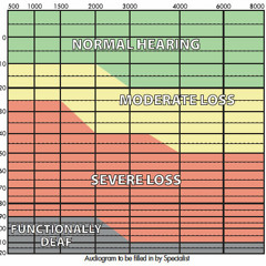 Audiology For Beginners - a self assessment radio hearing test