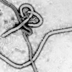 Ebola virus suspected in patient in Abitibi-Témiscamingue