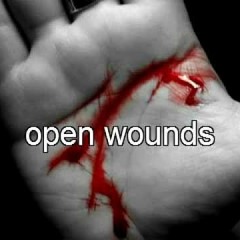 Skillet- Open Wounds