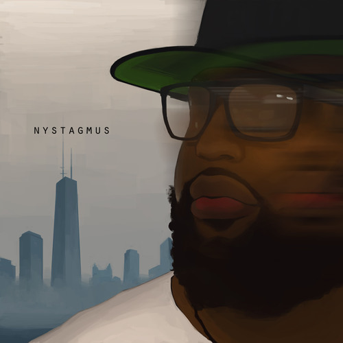 Nystagmus